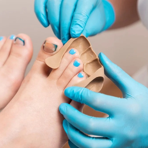 Ingrown Nail Treatment